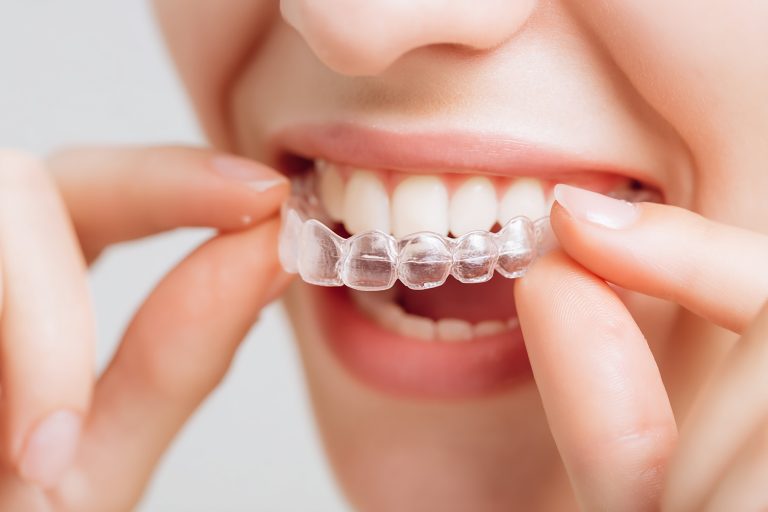 a smiling woman holding an invisalign braces or invisible retain